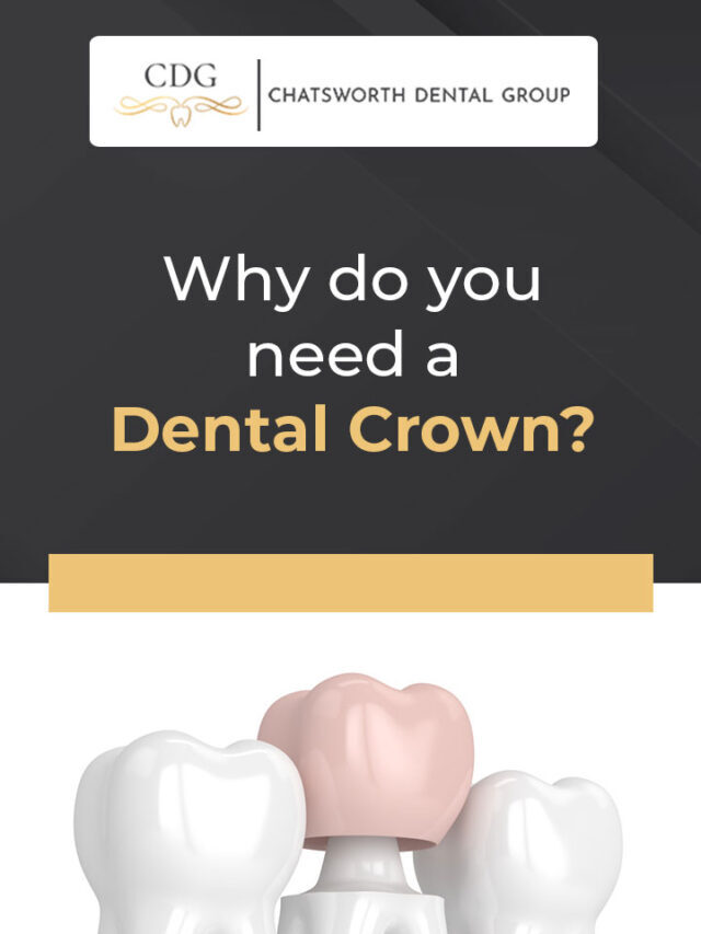 Why do you need a Dental Crown?